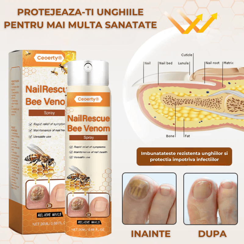 Solutie pentru CIUPERCA unghiilor